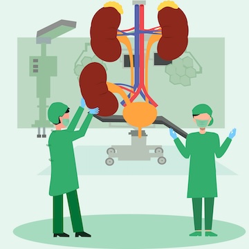 vector image Kidney Transplant stock vector